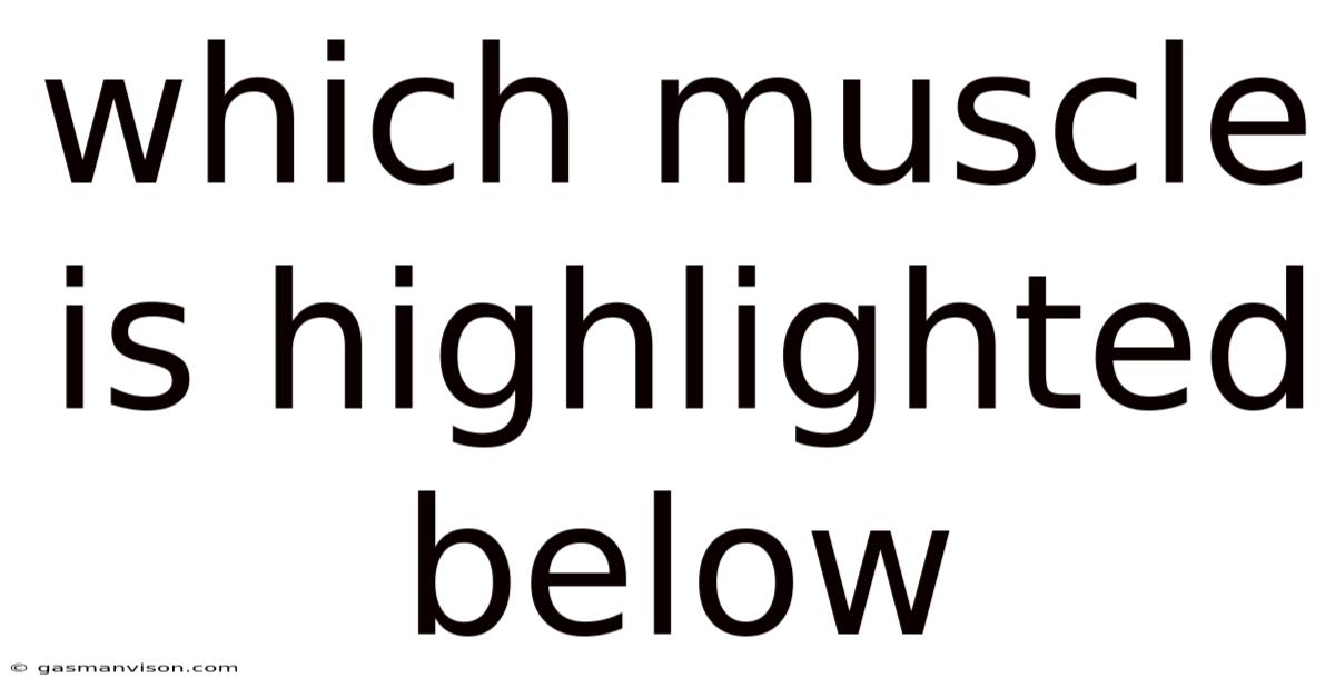 Which Muscle Is Highlighted Below